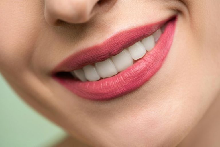 sorriso-perfetto-copertina
